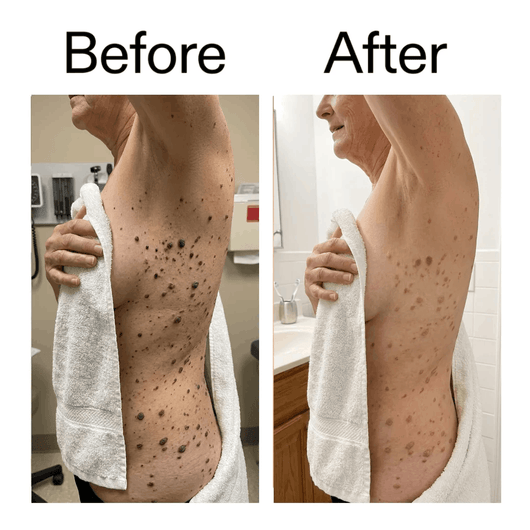 Smooth & Even Glycolic Body Stick